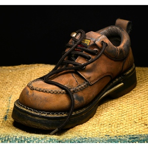 Come rimuovere la muffa dalle scarpe?